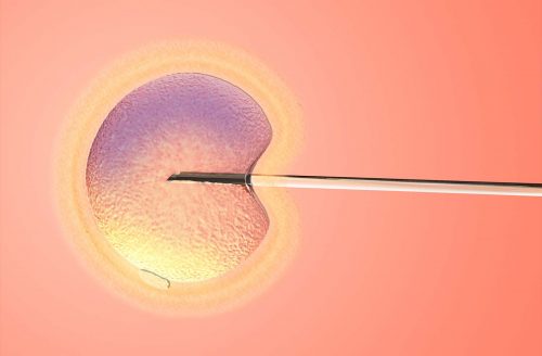 IVF-behandling – när storken låter vänta på sig